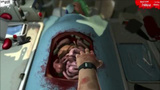 The Surgeon Simulator 2013 : De la chirurgie qui fait mal