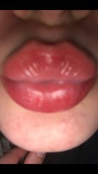 Avatar de [hypomanique]