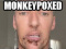 Avatar de MonkeyPoxGay
