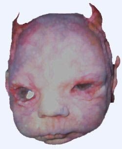 mattabby