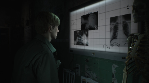 Silent Hill 2 Remake : le choix de la Bloober Team n'était pas une évidence pour Konami !